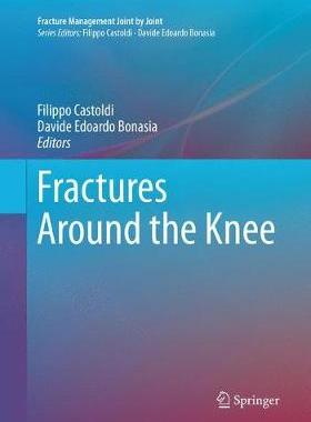 预订 Fractures Around the Knee