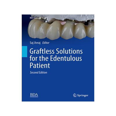 [预订]Graftless Solutions for the Edentulous Patient 9783031328466