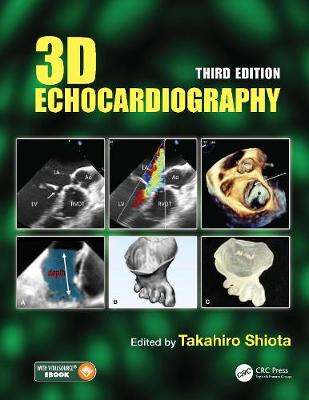 【预订】3D Echocardiography