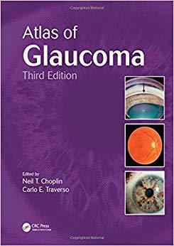 【预订】Atlas of Glaucoma, Third Edition