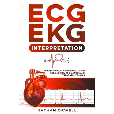 预订 ECG/EKG Interpretation: An Easy Approach to Read a 12-Lead ECG and How to Diagnose and Treat Arrhythmias