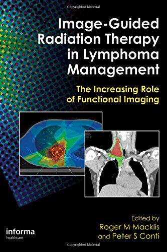 【预订】Image-Guided Radiation Therapy in Lymphoma Management