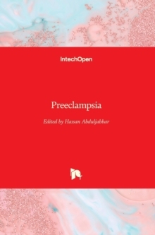 【预订】Preeclampsia 9781839692949