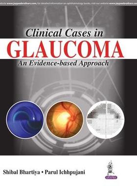 [预订]Clinical Cases in Glaucoma: An Evidence Based Approach 9789386056962