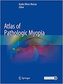 【预订】Atlas of Pathologic Myopia 9789811542633