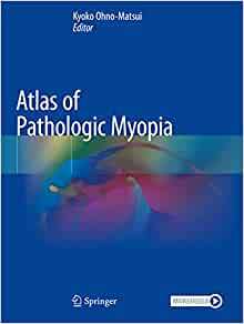 【预订】Atlas of Pathologic Myopia 9789811542633