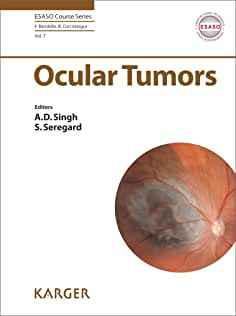 【预售】Ocular Tumors