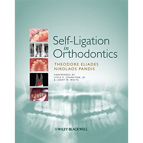 预订 Self-Ligation In Orthodontics 口腔正畸自锁托槽技术: 9781405181907