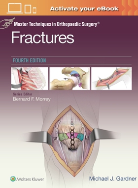 【预订】Master Techniques in Orthopaedic Surgery: Fractures