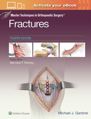 【预订】Master Techniques in Orthopaedic Surgery: Fractures