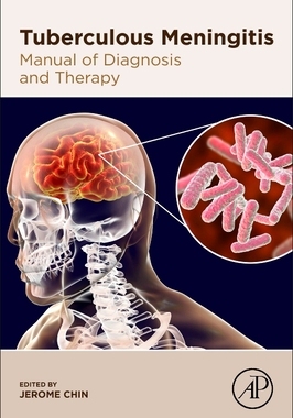 【预订】Tuberculous Meningitis: Manual of Diagnosis and Therapy