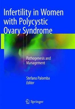 预订 Infertility in Women with Polycystic Ovary Syndrome