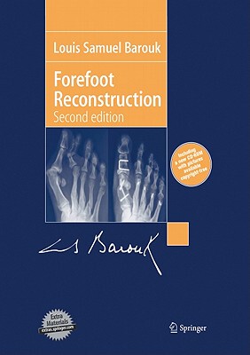 【预订】Forefoot Reconstruction