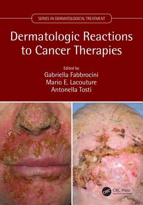 【预订】Dermatologic Reactions to Cancer Therapies