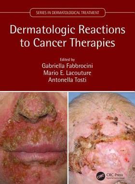 【预订】Dermatologic Reactions to Cancer Therapies