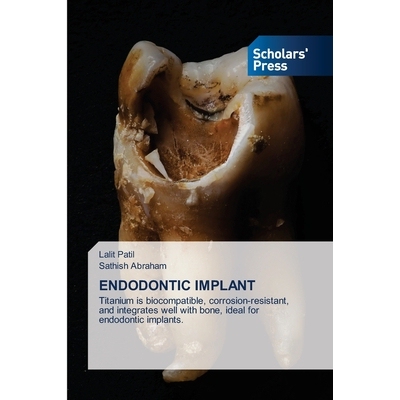 预订 Endodontic Implant 根管治疗植入体: 9786208848255