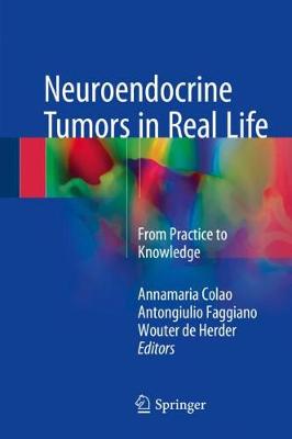 【预订】Neuroendocrine Tumors in Real Life