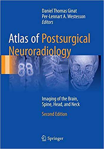 【预售】Atlas of Postsurgical Neuroradiology...