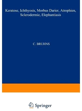 预订 Keratosen; Ichthyosis; Morbus Darier; Atrophien; Sclerodermie; Elephantiasis: 9783709131022