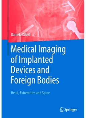 预订 Medical Imaging of Implanted Devices and Foreign Bodies: Head, Extremities and Spine 植入装置与异物的医学成像：头部