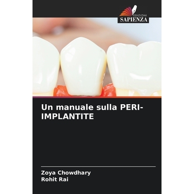预订 Un manuale sulla PERI-IMPLANTITE: 9786209333408