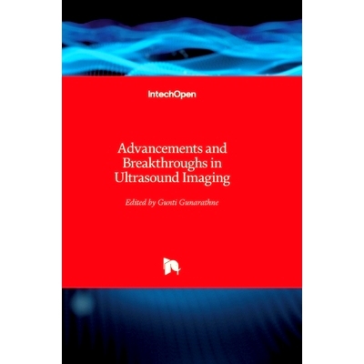 预订 Advancements and Breakthroughs in Ultrasound Imaging 超声成像的进步与突破: 9789535111597