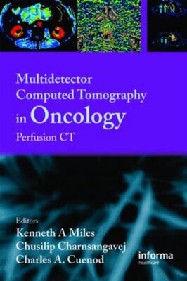 【预订】Multi-Detector Computed Tomography in Oncology