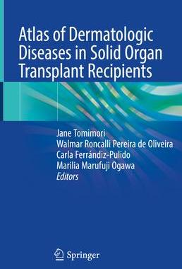 [预订]Atlas of Dermatologic Diseases in Solid Organ Transplant Recipients 9783031133343