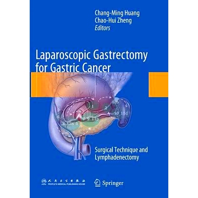 预订 Laparoscopic Gastrectomy for Gastric Cancer: Surgical Technique and Lymphadenectomy: 9789402403213