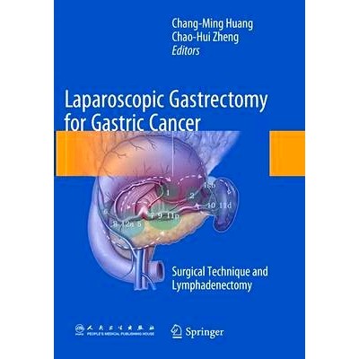 Surgical Technique and Lymphadenectomy