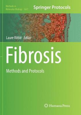 【预订】Fibrosis