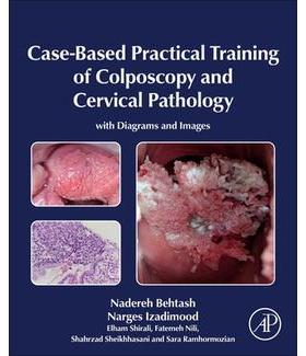 预订 Case-Based Practical Training of Colposcopy and Cervical Pathology