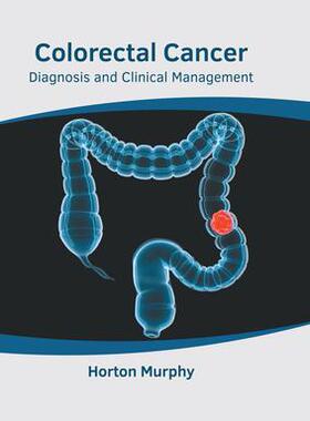 [预订]Colorectal Cancer: Diagnosis and Clinical Management 9781639891177