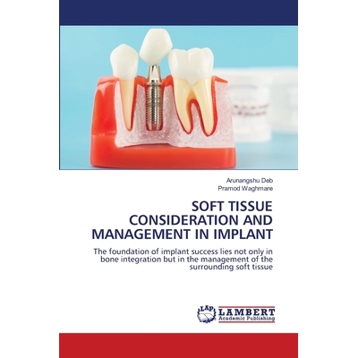 预订 Soft Tissue Consideration and Management in Implant 种植体软组织的考虑和处理: 9786208453879
