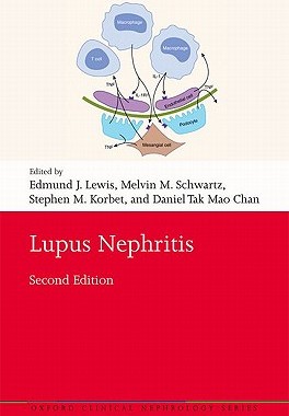 【预订】Lupus Nephritis