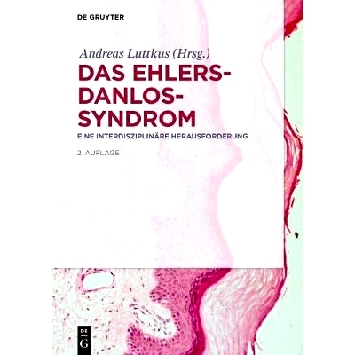 预订 Das Ehlers-Danlos-Syndrom: Eine interdisziplinäre Herausforderung: 9783110473643