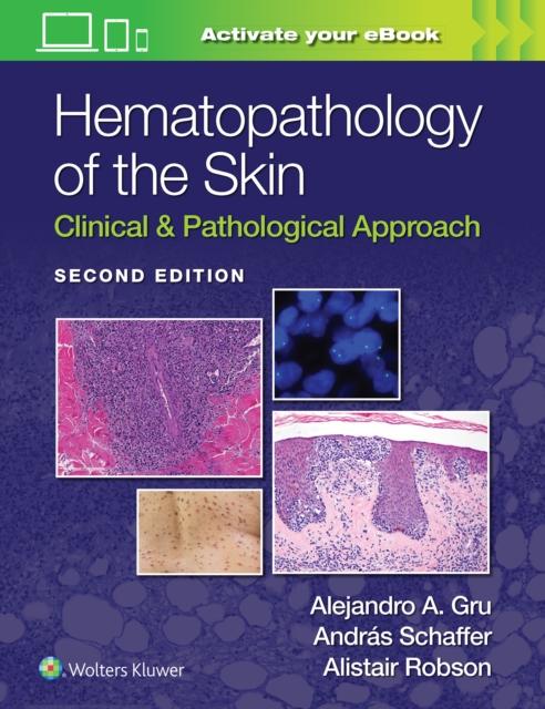 [预订]Hematopathology of the Skin: Clinical & Pathological Approach 9781975158552