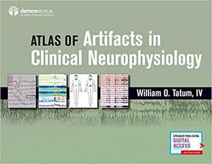 Clinical 预售 Neurophysiolog... Artifacts