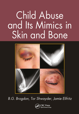 【预订】Child Abuse and its Mimics in Skin and Bone 9780367778187