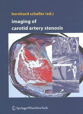 【预订】Imaging of Carotid Artery Stenosis