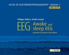 9782742015900 and Activation EEG. sleep artifacts 预订 Atlas Electroencephalography. procedures Awake
