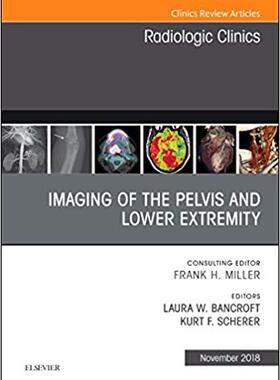 【预售】Imaging of the Pelvis and Lower Extremity, An Issue of Radiologic Clinics of North America