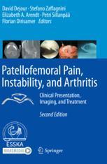 [预订]Patellofemoral Pain, Instability, and Arthritis 9783662610992