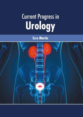 [预订]Current Progress in Urology 9781632429674