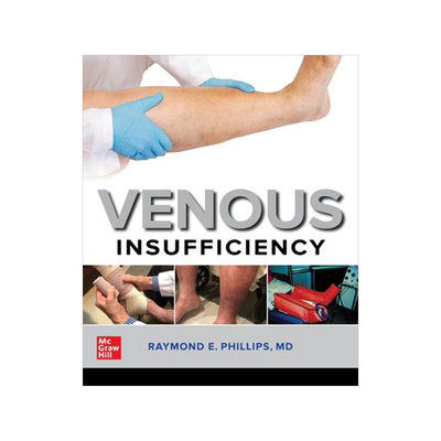 [预订]Venous Insufficiency 9781260461268