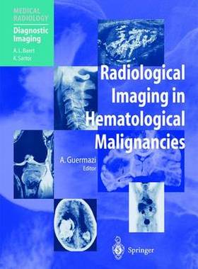 预订 Radiological Imaging in Hematological Malignancies