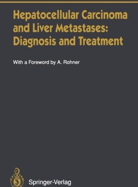 【预订】Hepatocellular Carcinoma and Liver Metastases: Diagnosis and Treatment