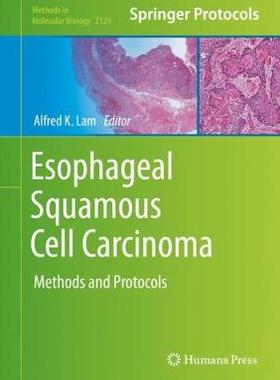 【预订】Esophageal Squamous Cell Carcinoma