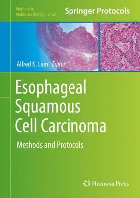 【预订】Esophageal Squamous Cell Carcinoma