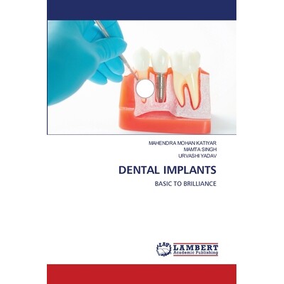 预订 Dental Implants 种植牙: 9786139620265